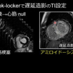 心臓MRIの基礎